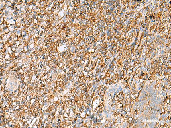 Immunohistochemistry of paraffin-embedded Human tonsil tissue using LGALS9 Polyclonal Antibody at dilution of 1:30(×200)