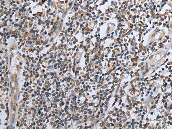 Immunohistochemistry of paraffin-embedded Human tonsil tissue using CXCL6 Polyclonal Antibody at dilution of 1:60(×200)