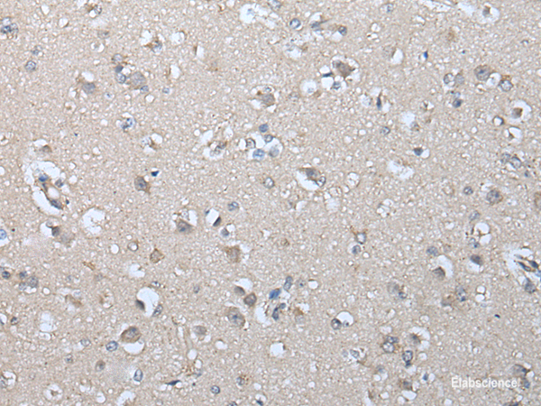 Immunohistochemistry of paraffin-embedded Human brain tissue using IFNB1 Polyclonal Antibody at dilution of 1:45(×200)