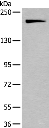 Western blot analysis of HUVEC cell lysate using IQGAP1 Polyclonal Antibody at dilution of 1:300