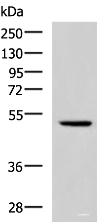 Western blot analysis of Hela cell lysate using IRF2 Polyclonal Antibody at dilution of 1:900