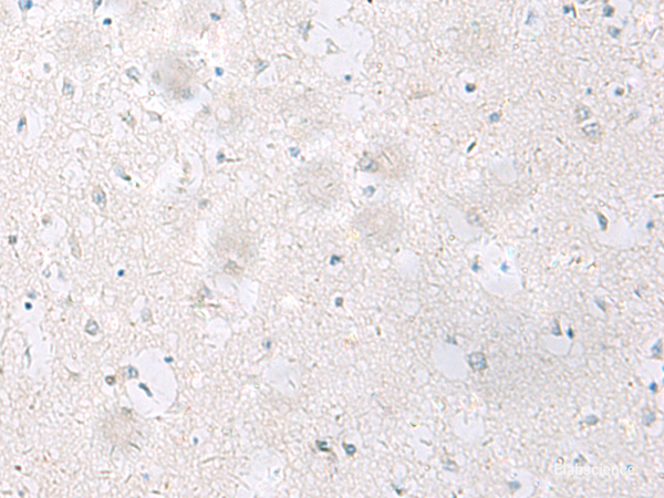 Immunohistochemistry of paraffin-embedded Human brain tissue using SST Polyclonal Antibody at dilution of 1:60(×200)