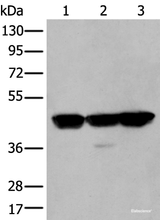 Western blot analysis of Hela A431 and Hepg2 cell lysates using PLAG1 Polyclonal Antibody at dilution of 1:200
