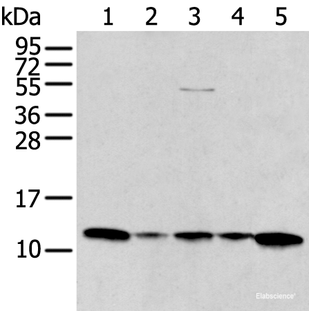 Western blot analysis of A431 Jurkat Lovo and Hepg2 cell Human breast cancer tissue lysates using CCL1 Polyclonal Antibody at dilution of 1:400