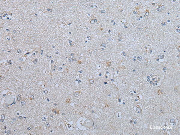 Immunohistochemistry of paraffin-embedded Human brain tissue using CENPF Polyclonal Antibody at dilution of 1:60(×200)