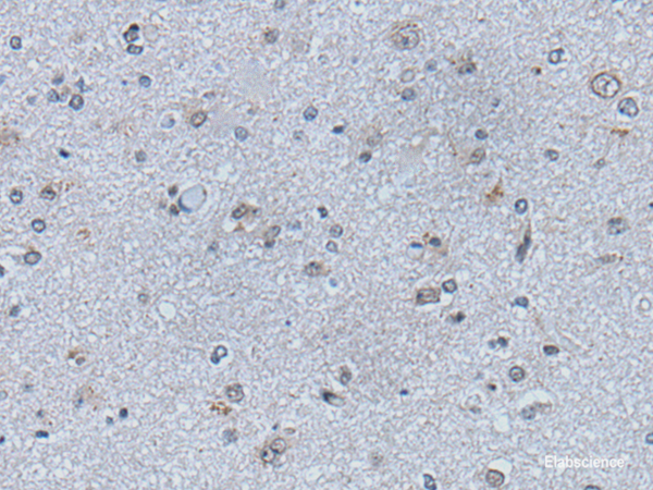 Immunohistochemistry of paraffin-embedded Human brain tissue using EFNB1 Polyclonal Antibody at dilution of 1:50(×200)