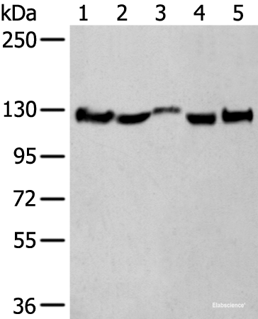 Western blot analysis of Rat brain tissue Mouse brain tissue Human fetal brain tissue Human cerebrum tissue Human cerebella tissue lysates using CNTN1 Polyclonal Antibody at dilution of 1:550