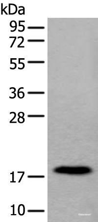 Western blot analysis of Human urinary bladder tissue lysate using MYL12B Polyclonal Antibody at dilution of 1:250
