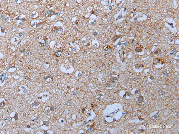 Immunohistochemistry of paraffin-embedded Human brain tissue using YPEL5 Polyclonal Antibody at dilution of 1:60(×200)