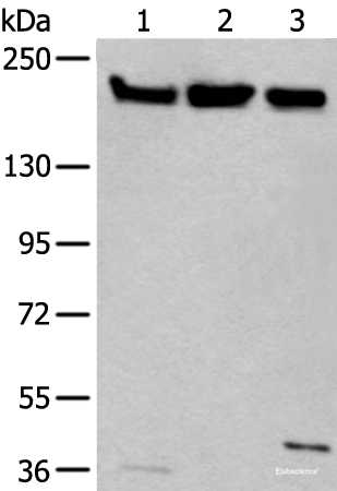 Western blot analysis of Hela 231 and K562 cell lysates using XRN1 Polyclonal Antibody at dilution of 1:250