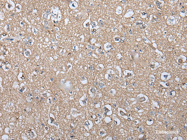 Immunohistochemistry of paraffin-embedded Human brain tissue using WIF1 Polyclonal Antibody at dilution of 1:100(×200)