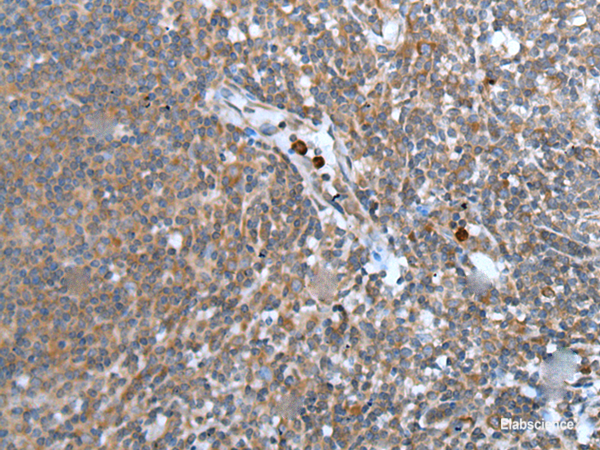 Immunohistochemistry of paraffin-embedded Human tonsil tissue using WISP2 Polyclonal Antibody at dilution of 1:45(×200)