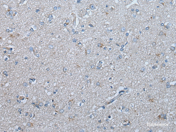 Immunohistochemistry of paraffin-embedded Human brain tissue using UBR4 Polyclonal Antibody at dilution of 1:65(×200)