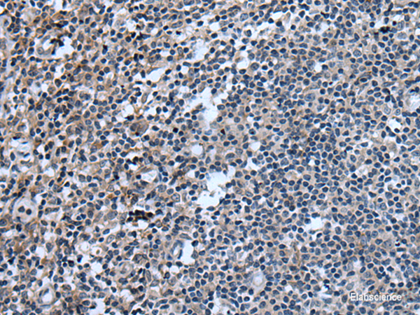 Immunohistochemistry of paraffin-embedded Human tonsil tissue using UGT8 Polyclonal Antibody at dilution of 1:55(×200)