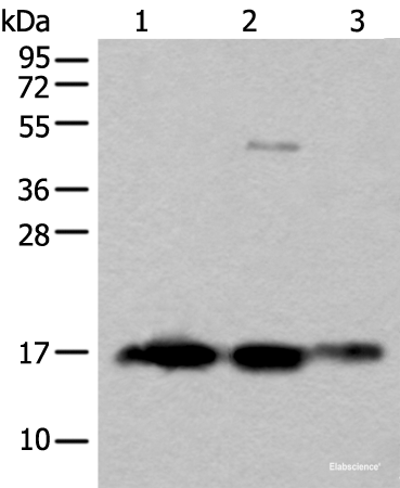 Western blot analysis of Rat brain tissue Human cerebrum tissue Human cerebella tissue lysates using SNCB Polyclonal Antibody at dilution of 1:450