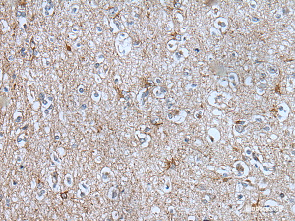 Immunohistochemistry of paraffin-embedded Human brain tissue using BMP1 Polyclonal Antibody at dilution of 1:105(×200)