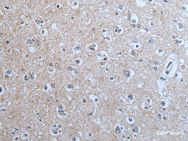 Immunohistochemistry of paraffin-embedded Human brain tissue using BRSK2 Polyclonal Antibody at dilution of 1:70(×200)