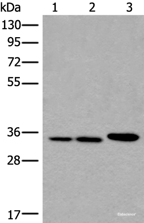 Western blot analysis of A549 Hela and K562 cell lysates using RPF2 Polyclonal Antibody at dilution of 1:400