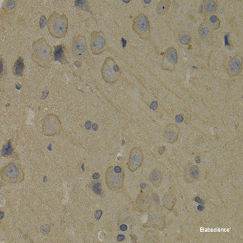 Immunofluorescence analysis of C6 cells using MYOD1 Polyclonal Antibody at dilution of 1:100. Blue: DAPI for nuclear staining.
