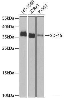 Western blot analysis of extracts of various cell lines using IKK beta Polyclonal Antibody at dilution of 1:1000.