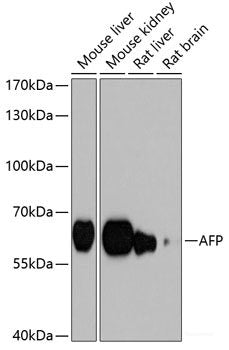 Immunohistochemistry of paraffin-embedded Rat pancreatic islet using TSC1 Polyclonal Antibody at dilution of 1:200 (40x lens).