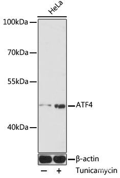 Immunohistochemistry of paraffin-embedded Human prostate using CBL Polyclonal Antibody at dilution of 1:200 (40x lens).