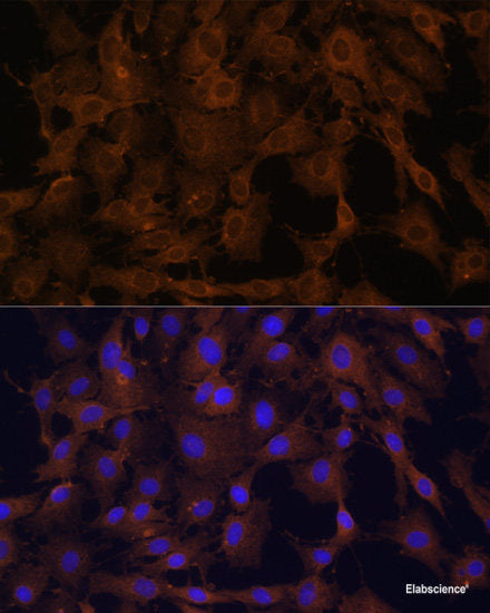Western blot analysis of extracts of various cell lines using STAT6 Polyclonal Antibody at dilution of 1:1000.