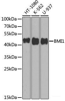 Immunohistochemistry of paraffin-embedded Human appendix using CD34 Polyclonal Antibody at dilution of 1:100 (40x lens).