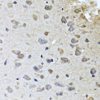 Immunohistochemistry of paraffin-embedded Rat heart using EIF2S1 Polyclonal Antibody at dilution of 1:100 (40x lens).