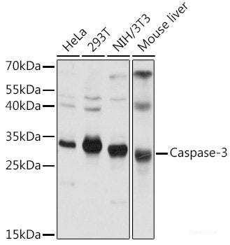 Western blot analysis of extracts of A-431 cells using ALK Polyclonal Antibody at dilution of 1:1000.