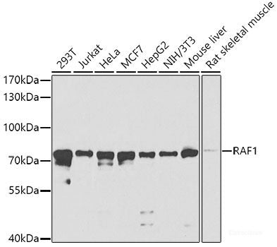 Immunohistochemistry of paraffin-embedded Rat ovary using PTCH1 Polyclonal Antibody at dilution of 1:100 (40x lens).