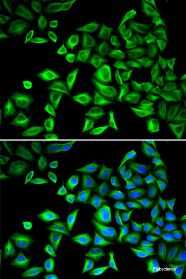 Immunofluorescence analysis of U2OS cells using BIRC3 Polyclonal Antibody at dilution of 1:100. Blue: DAPI for nuclear staining.