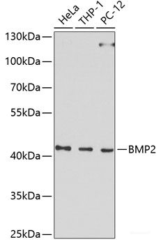 Immunofluorescence analysis of U2OS cells using NUR77 Polyclonal Antibody