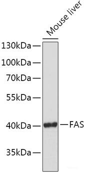 Immunohistochemistry of paraffin-embedded Human lung cancer using HDAC2 Polyclonal Antibody at dilution of 1:100 (40x lens).