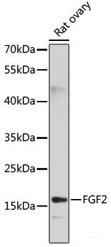 Western blot analysis of extracts of various cell lines using RPA1 Polyclonal Antibody at dilution of 1:3000.