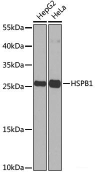 Western blot analysis of extracts of various cell lines using KU70 Polyclonal Antibody at dilution of 1:1000.