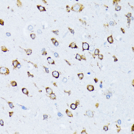 Immunohistochemistry of paraffin-embedded Rat ovary using CDK9 Polyclonal Antibody at dilution of 1:100 (40x lens).