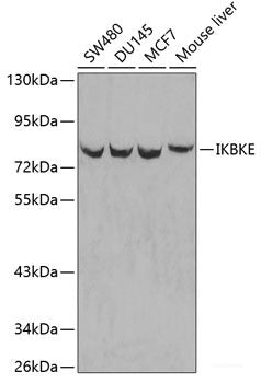 Immunohistochemistry of paraffin-embedded Rat pancreas using SLC1A2 Polyclonal Antibody at dilution of 1:100 (40x lens).