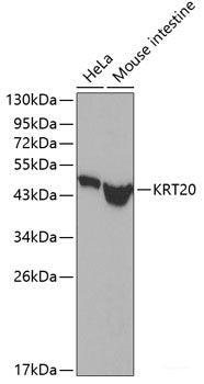 Western blot analysis of extracts of various cell lines using GRIN2A Polyclonal Antibody at dilution of 1:1000.