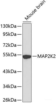 Immunohistochemistry of paraffin-embedded Rat kidney using FABP5 Polyclonal Antibody at dilution of 1:100 (40x lens).