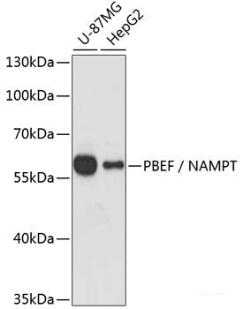 Western blot analysis of extracts of various cell lines using ERBB3 Polyclonal Antibody at dilution of 1:1000.