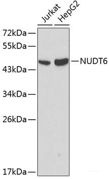 Immunohistochemistry of paraffin-embedded Human liver cancer using Caspase-1 Polyclonal Antibody at dilution of 1:100 (40x lens).