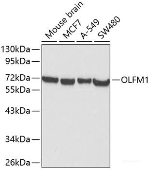 Immunohistochemistry of paraffin-embedded Human stomach using CTSB Polyclonal Antibody at dilution of 1:100 (40x lens).