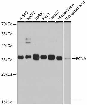Immunohistochemistry of paraffin-embedded Rat brain using GAD2 Polyclonal Antibody at dilution of 1:100 (40x lens).
