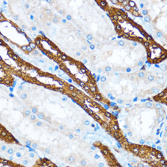 Immunofluorescence analysis of HeLa cells using TRAF6 Polyclonal Antibody