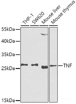 Immunofluorescence analysis of Jurkat cells using MyD88 Polyclonal Antibody at dilution of 1:100 (40x lens). Blue: DAPI for nuclear staining.
