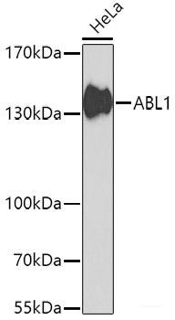 Immunohistochemistry of paraffin-embedded Human colon using MSH6 Polyclonal Antibody at dilution of 1:100 (40x lens).