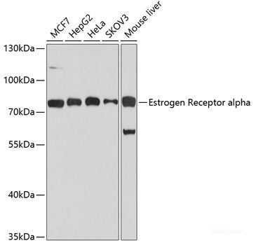 Immunofluorescence analysis of MCF-7 cells using RPA1 Polyclonal Antibody