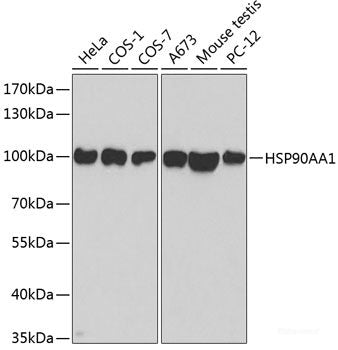 Immunohistochemistry of paraffin-embedded Mouse lung using MUC16 Polyclonal Antibody at dilution of 1:100 (40x lens).