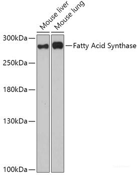 Immunofluorescence analysis of HeLa cells using CYP3A7 Polyclonal Antibody at dilution of 1:100 (40x lens). Blue: DAPI for nuclear staining.